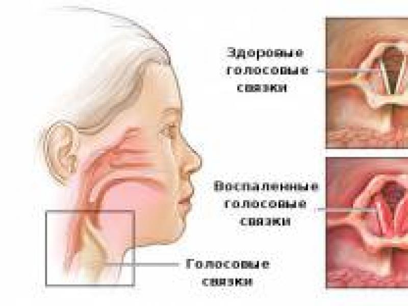 boli imune ale articulațiilor)